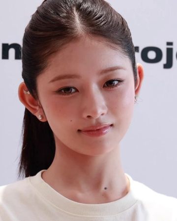 레이 사진
